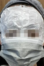 상담실, 진료실에서 편평사마귀 개수 진단을 믿으면 안 되는 이유 대표 이미지